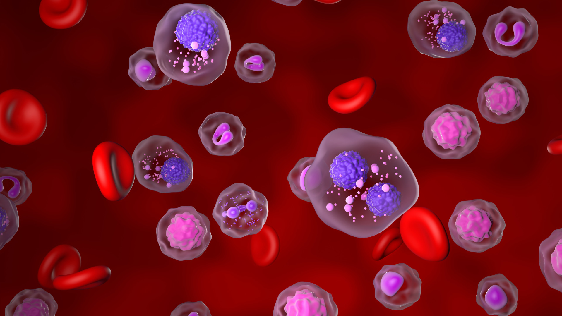 Multiple Myeloma: Symptoms, Diagnosis, Treatment, and Living Well After Diagnosis